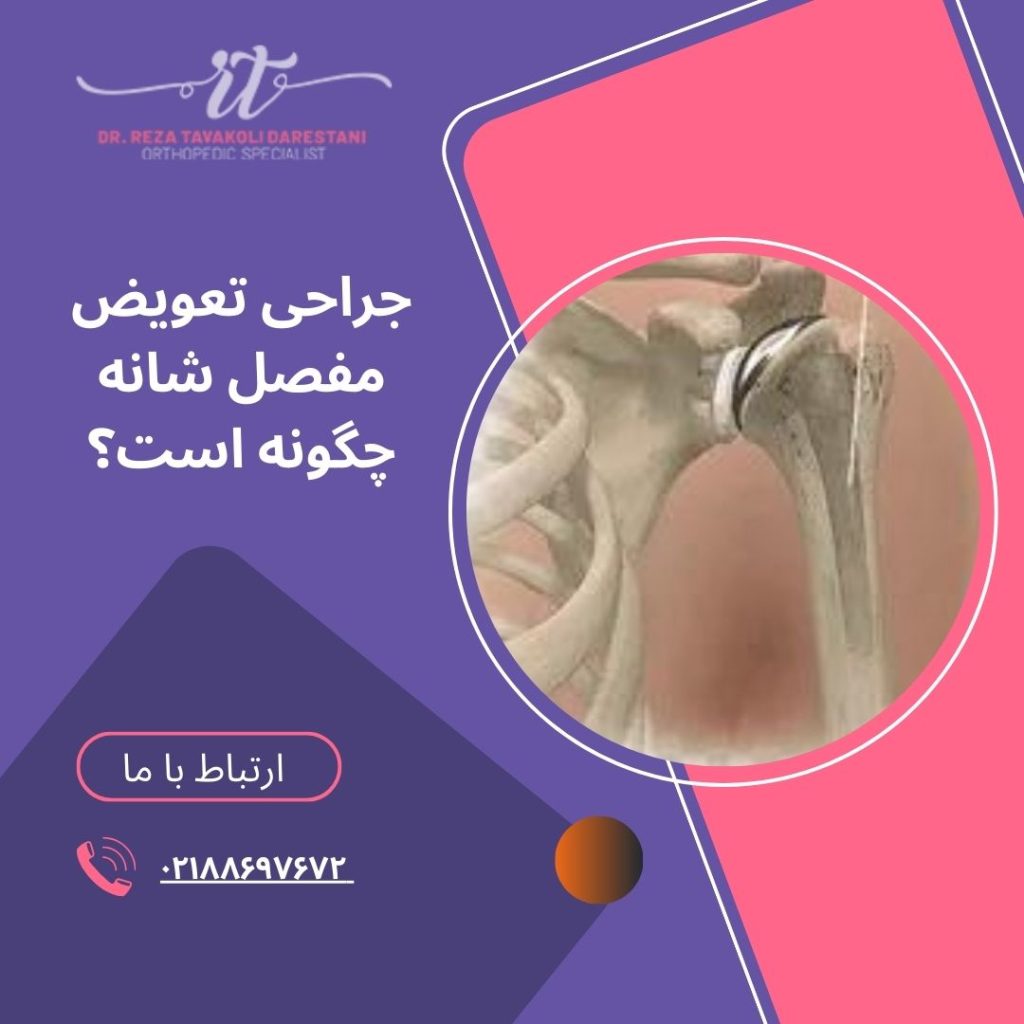 جراحی تعویض مفصل شانه چیست؟