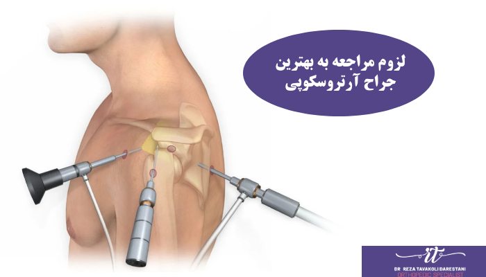 لزوم مراجعه به بهترین جراح آرتروسکوپی شانه