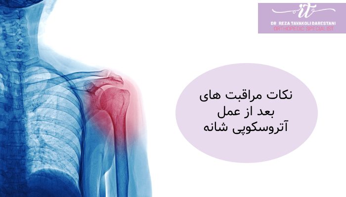 نکات مراقبت های بعد از عمل آرتروسکوپی شانه