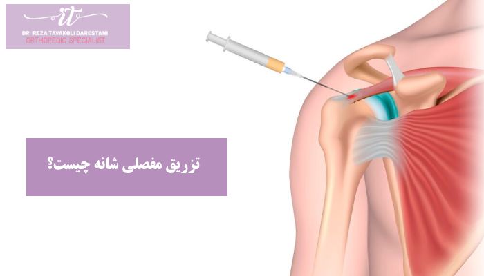 تزریق مفصلی شانه چیست؟ 