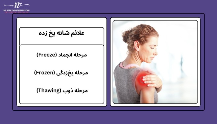 علائم شانه یخ زده