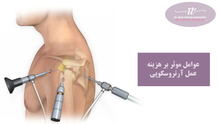 عوامل موثر بر هزینه عمل آرتروسکوپی شانه