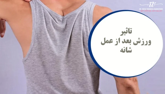 تاثیرات ورزش بعد از عمل شانه