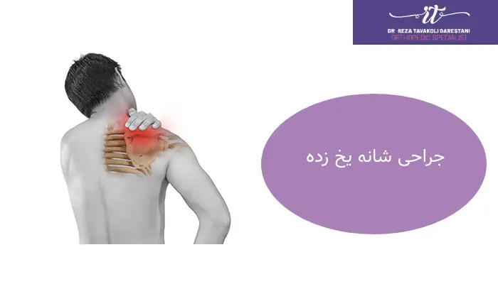 جراحی شانه یخ زده چیست؟