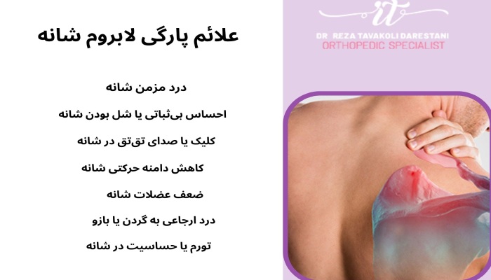 علائم پارگی لابروم شانه 