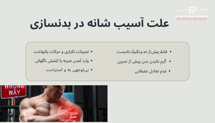 علت آسیب شانه در بدنسازی