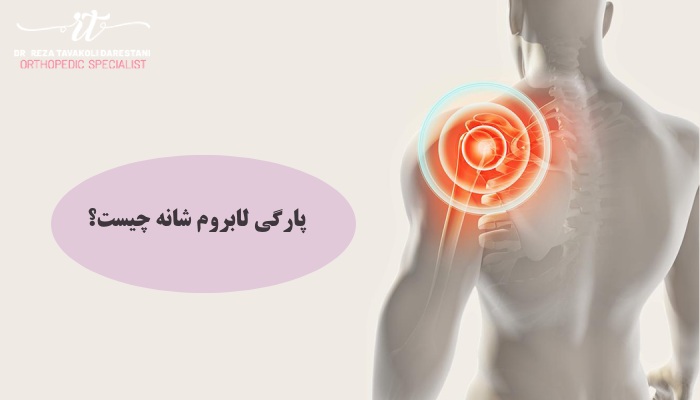 پارگی لابروم شانه چیست؟ 