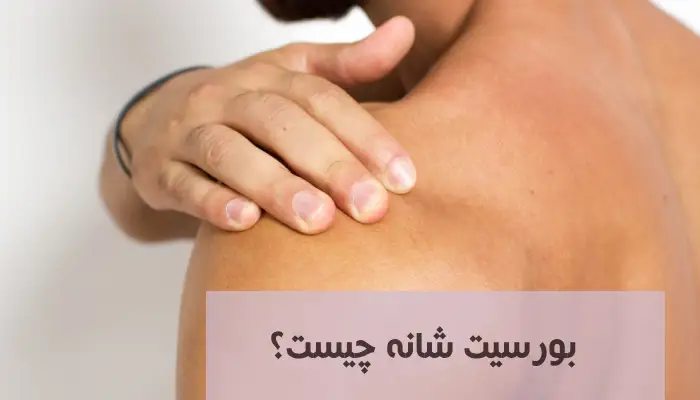 بورسیت شانه چیست؟