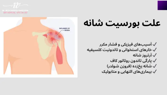 علت بورسیت شانه