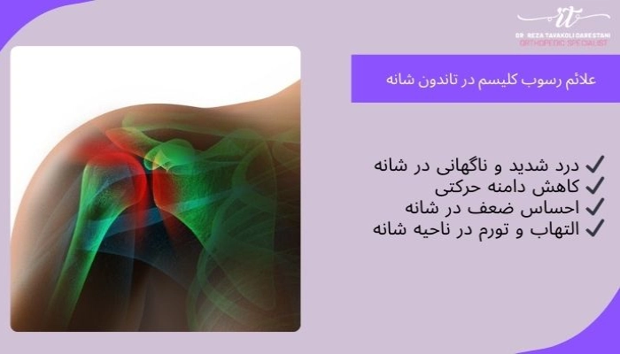 علائم رسوب کلسیم در شانه