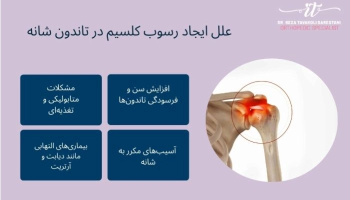 علت رسوب کلسیم در تاندون شانه
