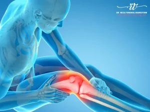 مراقبت های بعد از تعویض مفصل زانو