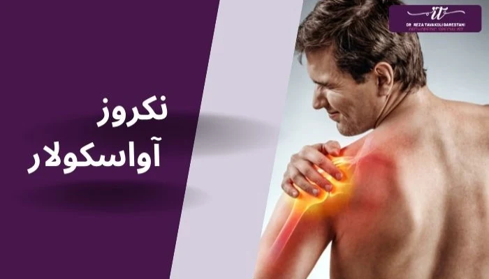 نکروز آواسکولار چیست