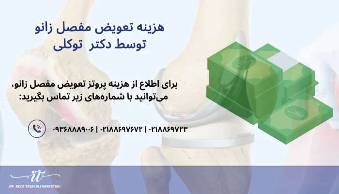 هزینه جراحی تعویض مفصل زانو