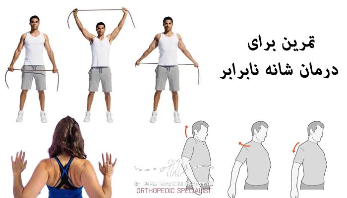 تمرین برای درمان شانه نابرابر