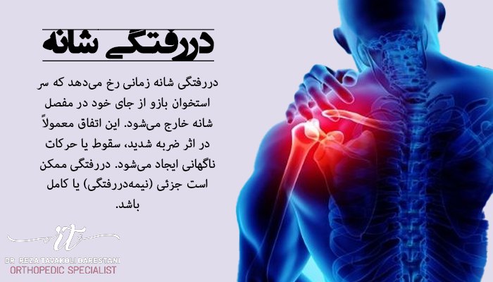 دررفتگی شانه