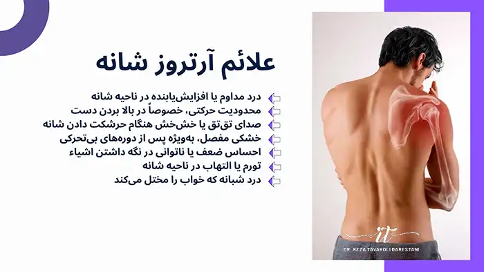 علائم آرتروز شانه