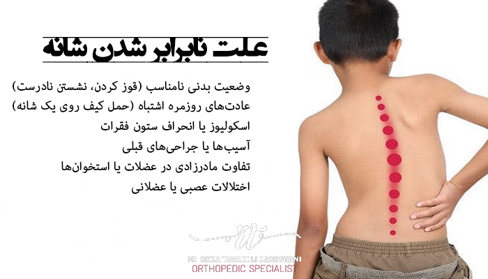 علت شانه نابرابر