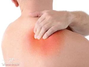 سوزش شانه
