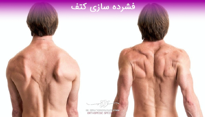 فشرده سازی کتف از حرکات اصلاحی برای گیر افتادگی شانه